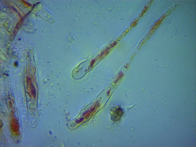 Scutellinia trechispora